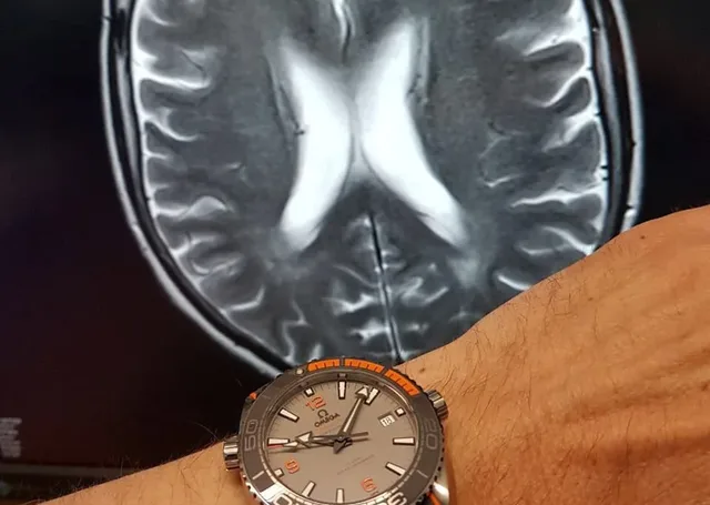 Die Omega Seamaster Planet Ocean 600 M Co-Axial Master Chronometer am Handgelenk von Dr. Röder bei der Befundung am MRT