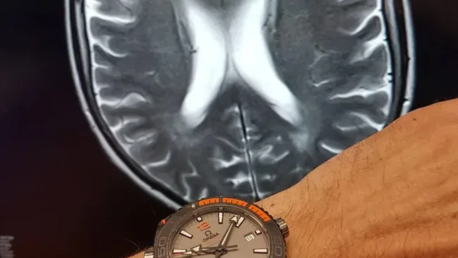 Die Omega Seamaster Planet Ocean 600 M Co-Axial Master Chronometer am Handgelenk von Dr. Röder bei der Befundung am MRT
